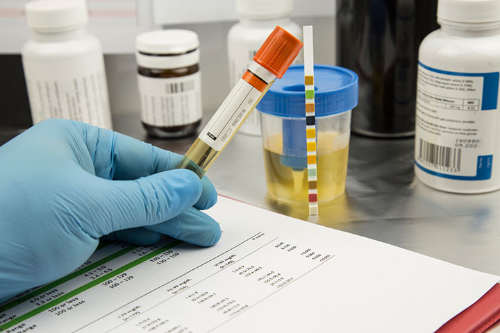 Urine Test Kit